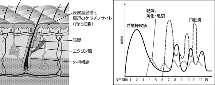 図1　上皮成長因子受容体（EGRF）の皮膚における局在と皮膚障害の発症時期